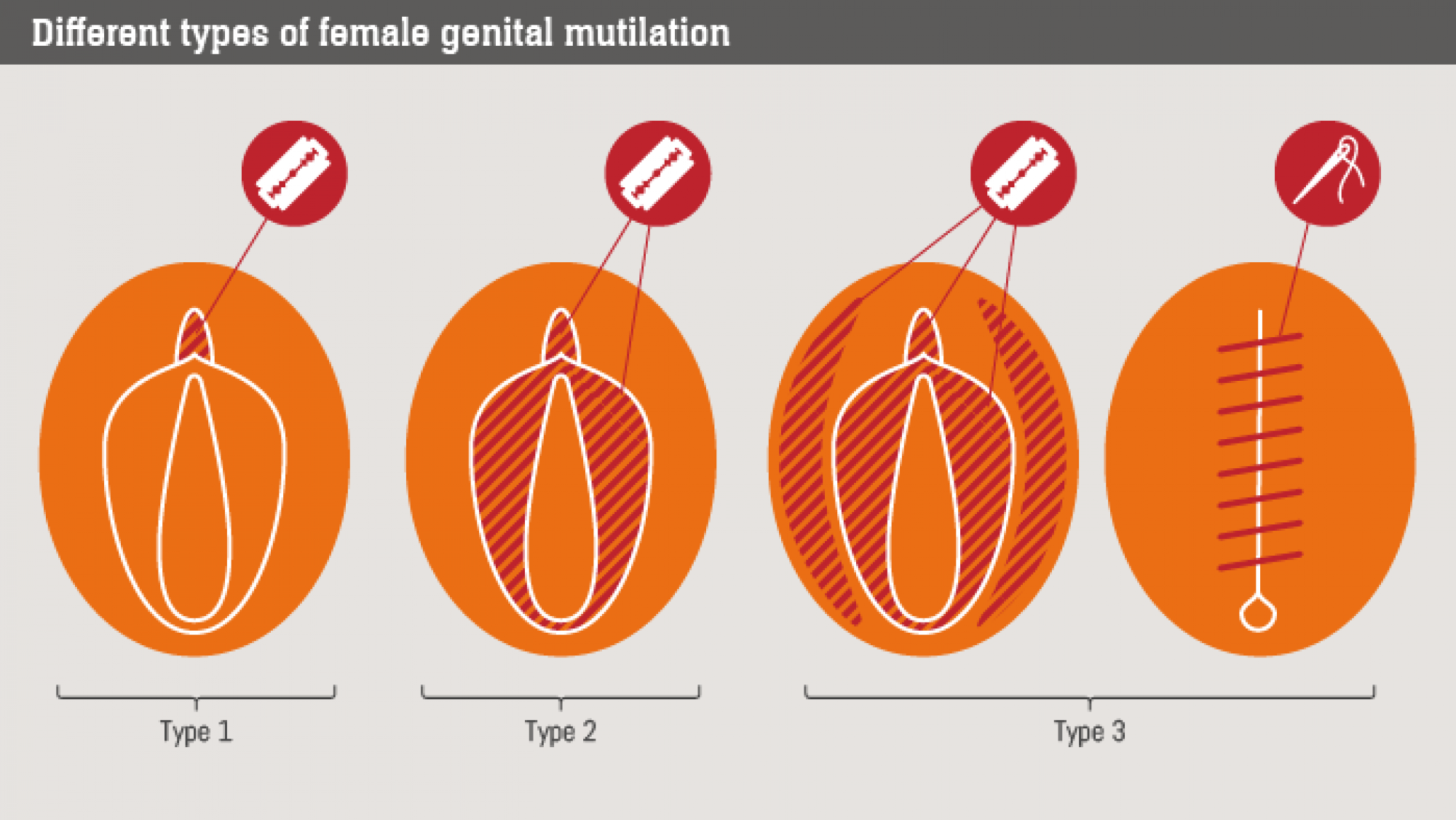 FGM-diagram-2000x0-c-default